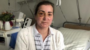 Alman Polisi Saldırganın Yakalanması İçin Halktan Yardım istedi