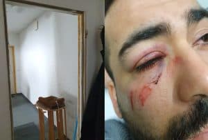 Yanlış Adres Kurbanı Oldu, Alman Özel Kuvvetleri Tarafından Darbedildi